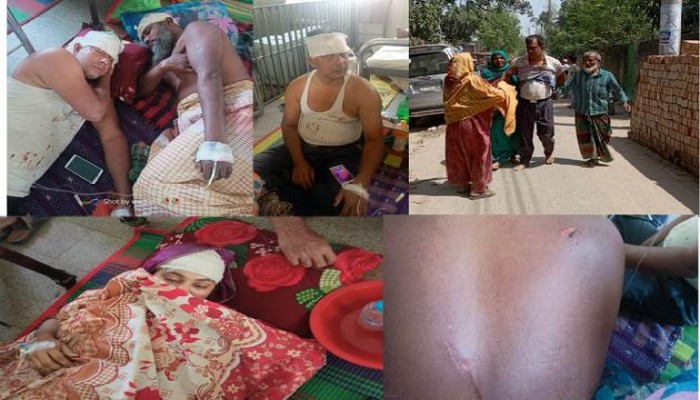 রাজশাহীর কাশিয়াডাঙ্গায় জমি সংক্রান্ত বিরোধের জেরে সংঘর্ষে আহত ১০