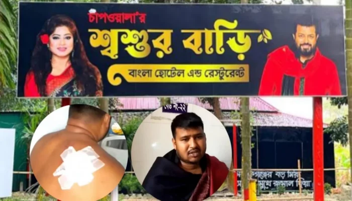 ওমর সানীর রেস্তোরাঁয় কাস্টমারকে কুপিয়ে জখম