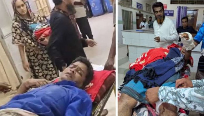 রাজশাহীতে মামলা তোলায় রাজি না হওয়ায় সাংবাদিকের  আঙুল কর্তন